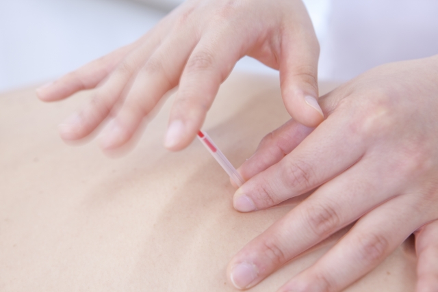 acupuncture that approaches stiff shoulders, back pain, and sciatica painful